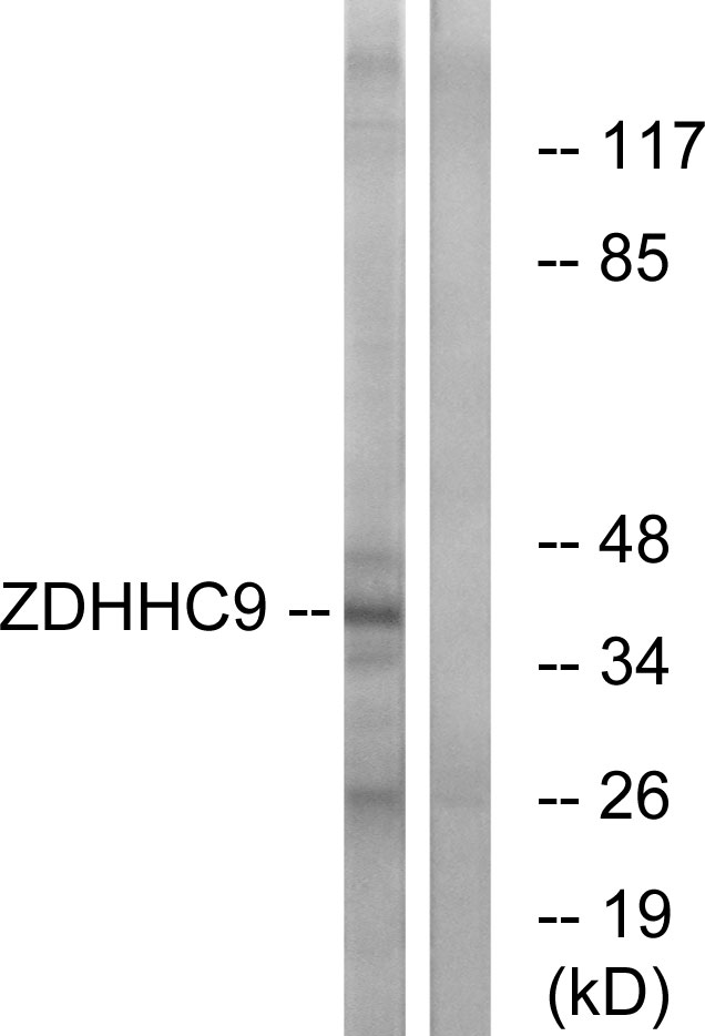 ZDHHC9 Antibody - Western blot analysis of lysates from COLO cells, using ZDHHC9 Antibody. The lane on the right is blocked with the synthesized peptide.