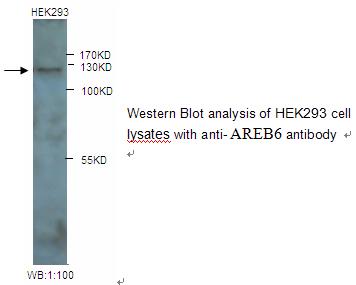 ZEB1 / AREB6 Antibody