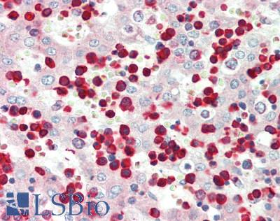 ZEB2 / SIP-1 Antibody - Human Fetal Liver: Formalin-Fixed, Paraffin-Embedded (FFPE)