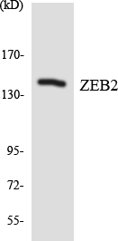 ZEB2 / SIP-1 Antibody - Western blot analysis of the lysates from HepG2 cells using ZEB2 antibody.