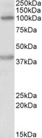 ZEB2 / SIP-1 Antibody - ZEB2 antibody (0.2 ug/ml) staining of Human Liver lysate (35 ug protein/ml in RIPA buffer). Primary incubation was 1 hour. Detected by chemiluminescence.
