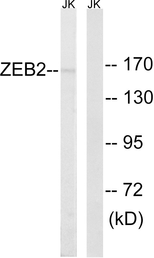 ZEB2 / SIP-1 Antibody - Western blot analysis of lysates from Jurkat cells, using ZEB2 Antibody. The lane on the right is blocked with the synthesized peptide.