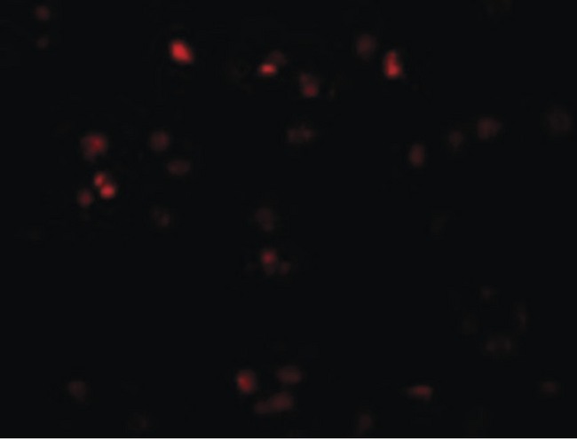 ZEB2 / SIP-1 Antibody - Immunofluorescence of ZEB2 in Jurkat cells with ZEB2 antibody at 20 ug/ml.