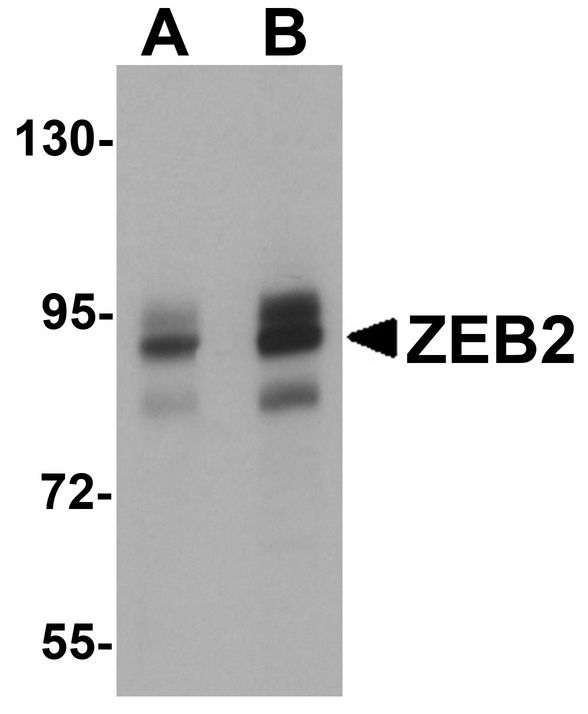 ZEB2 / SIP-1 Antibody - Western blot analysis of ZEB2 in Jurkat cell lysate with ZEB2 antibody at (A) 1 and (B) 2ug/ml.