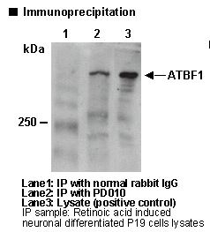 ZFHX3 / ATBF1 Antibody