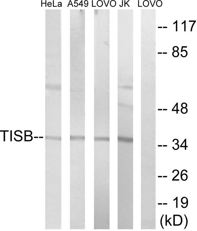 ZFP36L1 Antibody - Western blot analysis of lysates from Jurkat, HeLa, A549, and LOVO cells, using TISB Antibody. The lane on the right is blocked with the synthesized peptide.