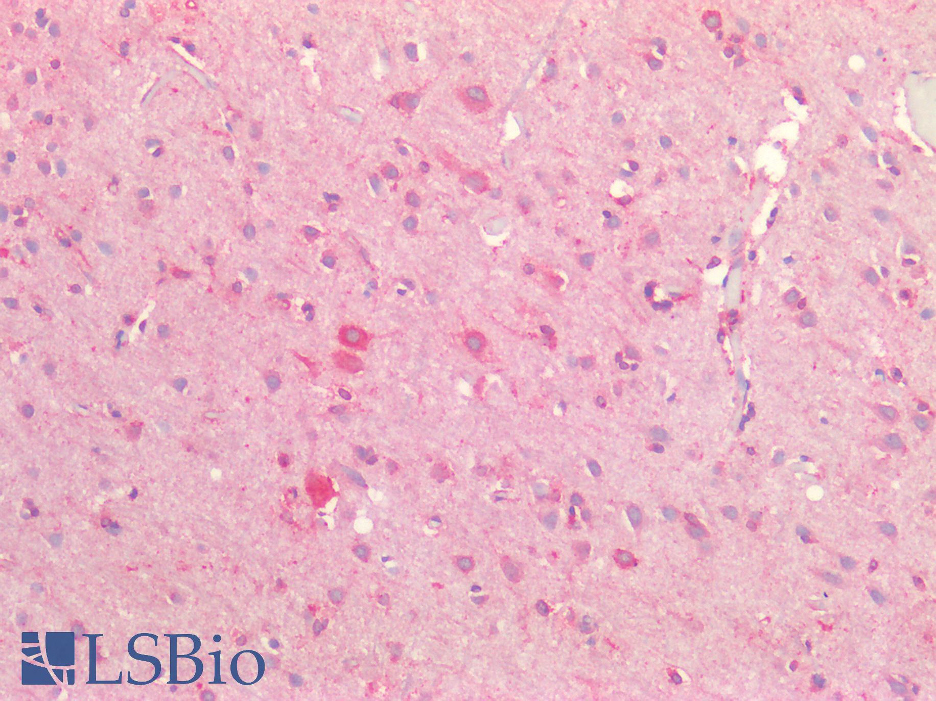 ZFP91 Antibody - Human Brain, Cortex: Formalin-Fixed, Paraffin-Embedded (FFPE)