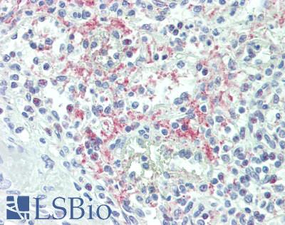 ZFPM1 / FOG1 Antibody - Human Spleen: Formalin-Fixed, Paraffin-Embedded (FFPE), at a dilution of 1:100.
