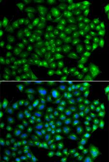 ZFYVE1 / DFCP1 Antibody - Immunofluorescence analysis of A549 cells.
