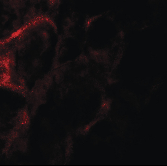 ZFYVE21 Antibody - Immunofluorescence of ZF21 in human kidney tissue with ZF21 antibody at 20 ug/ml.