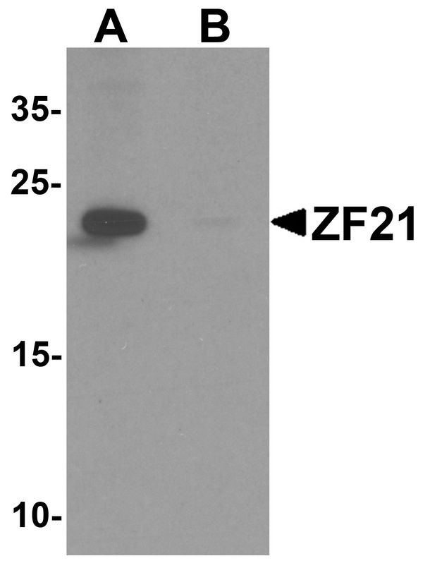 ZFYVE21 Antibody - Western blot analysis of ZF21 in 3T3 cell tissue lysate with ZF21 antibody at 1 ug/ml in (A) the absence and (B) the presence of blocking peptide.