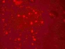 ZGPAT Antibody - Immunofluorescence of ZGPAT in human brain cells with ZGPAT antibody at 20 µg/mL.