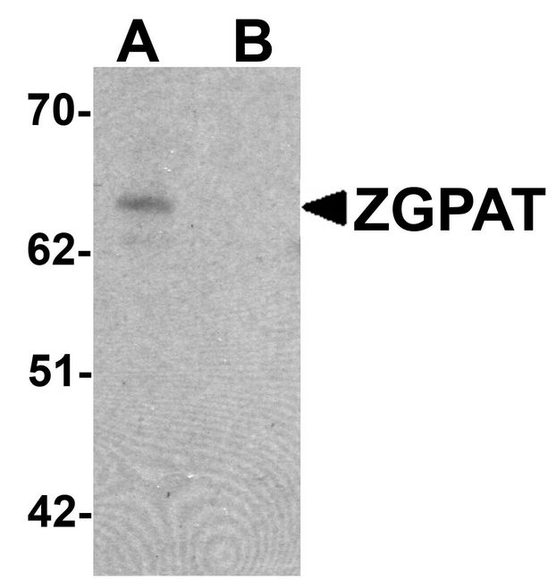 ZGPAT Antibody - Western blot analysis of ZGPAT in SK-N-SH cell lysate with ZGPAT antibody at 1 ug/ml in (A) the absence and (B) the presence of blocking peptide.
