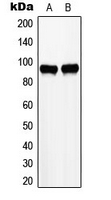 ZHX2 / RAF Antibody - Western blot analysis of ZHX2 expression in HepG2 (A); K562 (B) whole cell lysates.