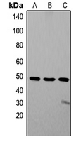 ZIC1+2+3 Antibody - Western blot analysis of ZIC1/2/3 expression in SW480 (A); Jurkat (B); SHSY5Y (C) whole cell lysates.