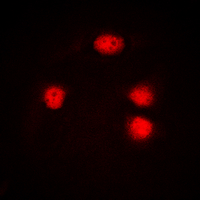 ZIC1+2+3 Antibody - Immunofluorescent analysis of ZIC1/2/3 staining in Jurkat cells. Formalin-fixed cells were permeabilized with 0.1% Triton X-100 in TBS for 5-10 minutes and blocked with 3% BSA-PBS for 30 minutes at room temperature. Cells were probed with the primary antibody in 3% BSA-PBS and incubated overnight at 4 deg C in a humidified chamber. Cells were washed with PBST and incubated with a DyLight 594-conjugated secondary antibody (red) in PBS at room temperature in the dark. DAPI was used to stain the cell nuclei (blue).