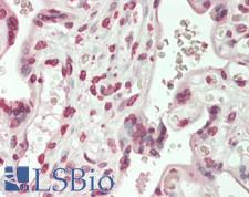 ZIC1+2+3 Antibody - Human Placenta: Formalin-Fixed, Paraffin-Embedded (FFPE)