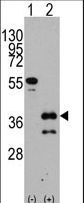 ZIC4 Antibody - Western blot of ZIC4 (arrow) using rabbit polyclonal ZIC4 Antibody. 293 cell lysates (2 ug/lane) either nontransfected (Lane 1) or transiently transfected with the ZIC4 gene (Lane 2) (Origene Technologies).