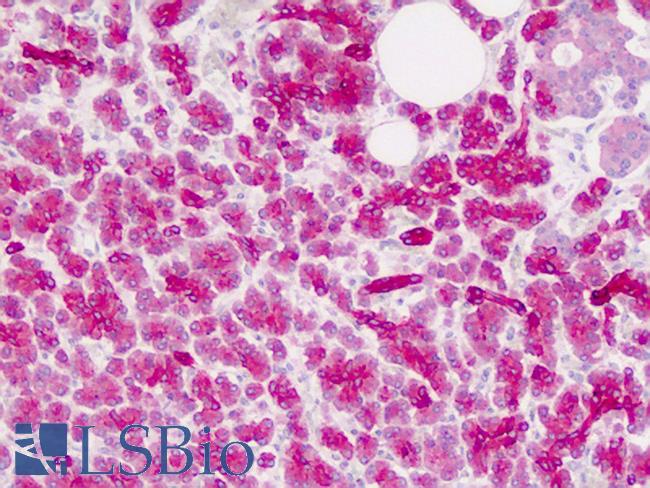 ZIC4 Antibody - Human Pancreas: Formalin-Fixed, Paraffin-Embedded (FFPE)