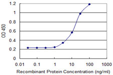 ZIC4 Antibody - Detection limit for recombinant GST tagged ZIC4 is 1 ng/ml as a capture antibody.