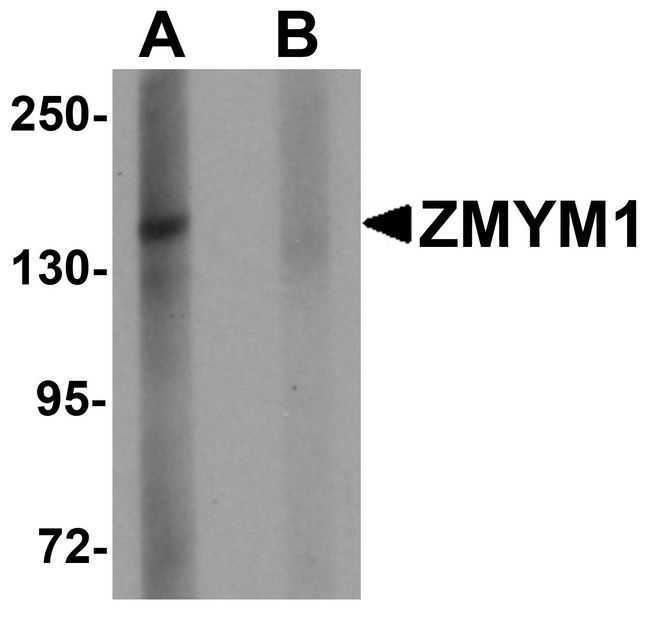 ZMYM1 Antibody - Western blot analysis of ZMYM1 in rat lung tissue lysate with ZMYM1 antibody at 1 ug/ml in (A) the absence and (B) the presence of blocking peptide.
