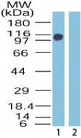 ZMYM2 / RAMP Antibody - Western blot of Zinc finger protein 198 in mouse skeletal muscle lysate in the 1) absence and 2) presence of immunizing peptide using antibody at0.1 ug/ml.