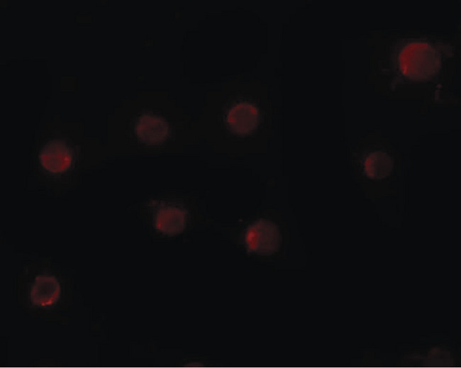 ZMYM2 / RAMP Antibody - Immunofluorescence of ZMYM2 in HeLa cells with ZMYM2 antibody at 20 ug/ml.