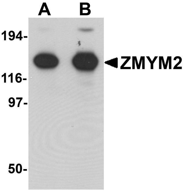 ZMYM2 / RAMP Antibody - Western blot analysis of ZMYM2 in EL4 cell lysate with ZMYM2 antibody at (A) 0.125 and (B) 0.25 ug/ml.