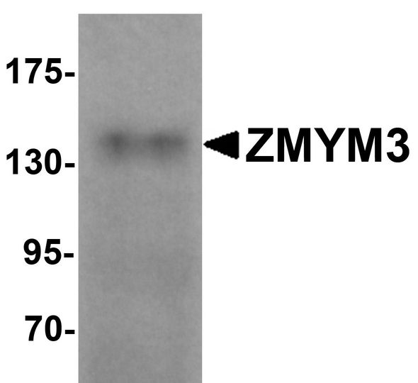 ZMYM3 Antibody - Western blot analysis of ZMYM3 in human brain tissue lysate with ZMYM3 antibody at 1 ug/ml.