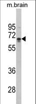 ZMYND11 / BS69 Antibody - Western blot of ZMYND11 Antibody in mouse brain tissue lysates (35 ug/lane). ZMYND11 (arrow) was detected using the purified antibody.
