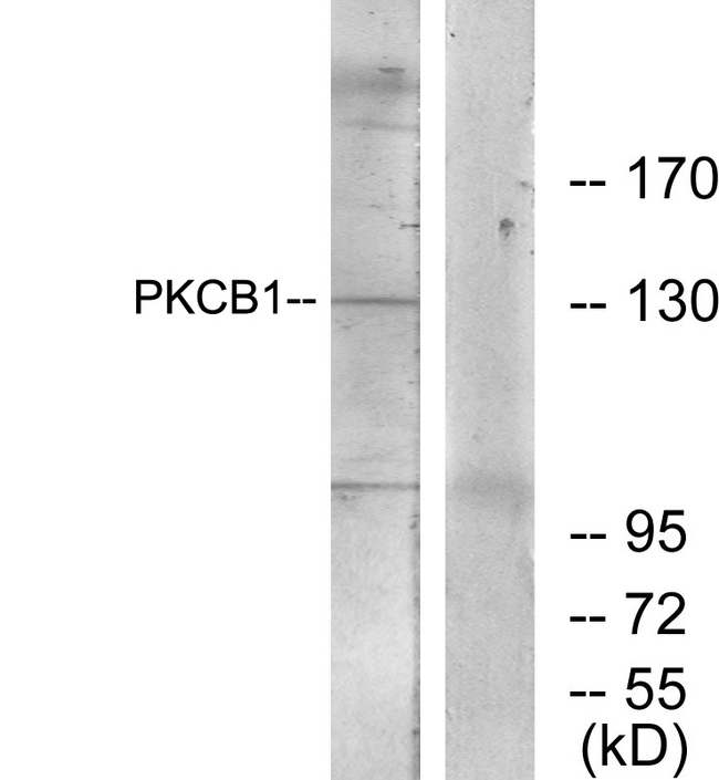 ZMYND8 / RACK7 Antibody - Western blot analysis of lysates from 293 cells, using PKCB1 Antibody. The lane on the right is blocked with the synthesized peptide.