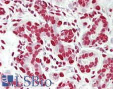 ZNF335 / NIF1 Antibody - Human Breast: Formalin-Fixed, Paraffin-Embedded (FFPE)