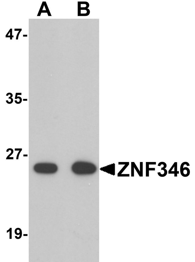 ZNF346 Antibody - Western blot analysis of TRIP6 in EL4 cell lysate with TRIP6 antibody at 1 ug/ml.