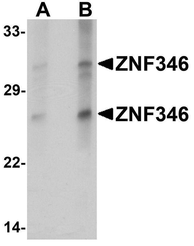 ZNF346 Antibody - Western blot analysis of ZNF346 in human kidney tissue lysate with ZNF346 antibody at (A) 1 and (B) 2 ug/ml.