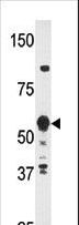 ZNF395 Antibody - Western blot of anti-HDBP2(HDRF-2) Antibody in Y79 cell line lysates (35 ug/lane). HDBP2(arrow) was detected using the purified antibody.