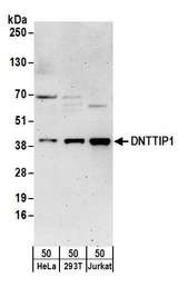 ZNF423 / OAZ Antibody - Detection of human DNTTIP1 by western blot. Samples: Whole cell lysate (50 µg) from HeLa, HEK293T, and Jurkat cells. Antibodies: Affinity purified rabbit anti-DNTTIP1 antibody used for WB at 0.1 µg/ml. Detection: Chemiluminescence with an exposure time of 3 minutes.