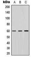 ZNF496 / NZIP1 Antibody - Western blot analysis of ZNF496 expression in HEK293T (A); Raw264.7 (B); PC12 (C) whole cell lysates.