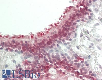 ZNF496 / NZIP1 Antibody - Human Lung, Respiratory Epithelium: Formalin-Fixed, Paraffin-Embedded (FFPE)