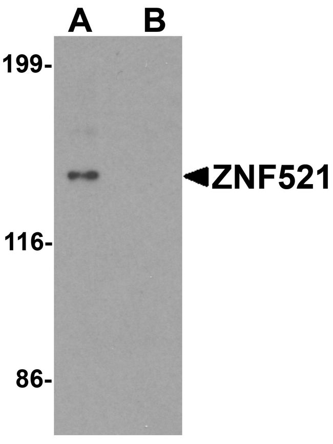 ZNF521 Antibody - Western blot analysis of ZNF521 in HeLa cell lysate with ZNF521 antibody at 1 ug/ml in (A) the absence and (B) the presence of blocking peptide.