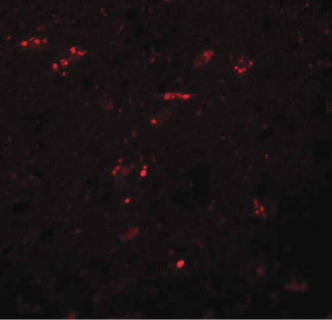 ZNF536 Antibody - Immunofluorescence of ZNF536 in human brain tissue with ZNF536 antibody at 20 ug/ml.