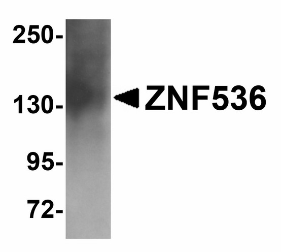 ZNF536 Antibody - Western blot of ZNF536 in human brain tissue lysate with ZNF536 antibody at 1 ug/ml.