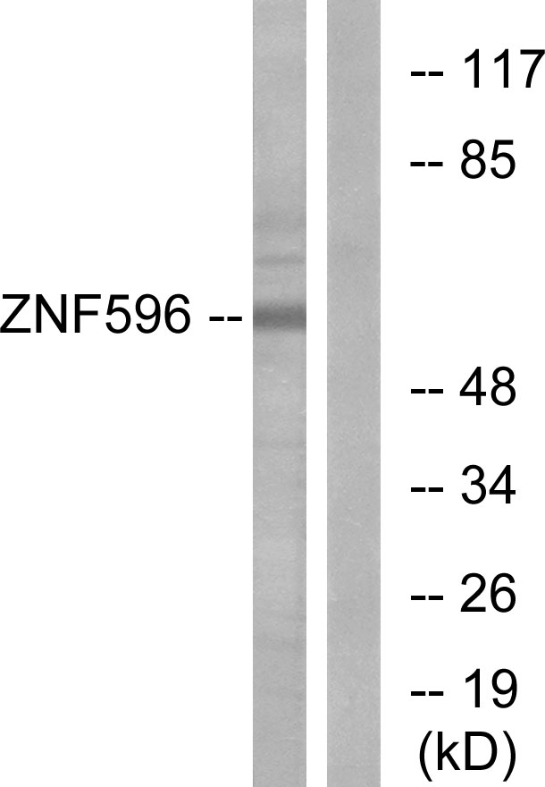 ZNF596 Antibody - Western blot analysis of lysates from Jurkat cells, using ZNF596 Antibody. The lane on the right is blocked with the synthesized peptide.