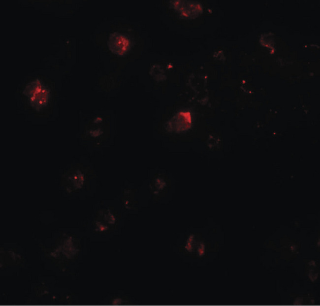 ZNF687 Antibody - Immunofluorescence of ZNF687 in Jurkat cells with ZNF687 antibody at 20 ug/ml.