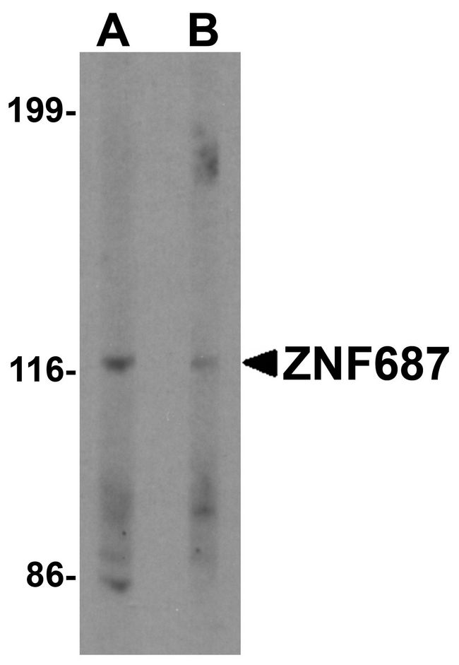 ZNF687 Antibody - Western blot analysis of ZNF687 in Jurkat cell lysate with ZNF687 antibody at 0.5 ug/ml in (A) the absence and (B) the presence of blocking peptide.