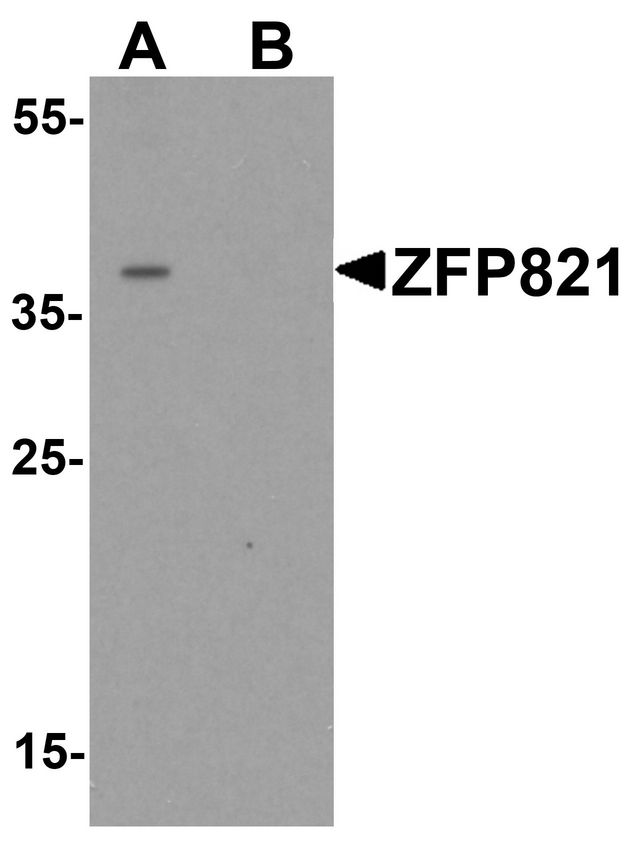 ZNF821 Antibody - Western blot analysis of ZNF821 in Jurkat cell lysate with ZNF821 antibody at 0.5 ug/ml in (A) the absence and (B) the presence of blocking peptide.