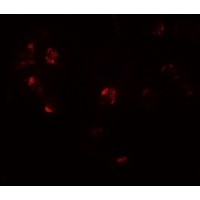 ZNF821 Antibody - Immunofluorescence ofZNF821 in Jurkat cells with ZNF821 antibody at 20 µg/mL.