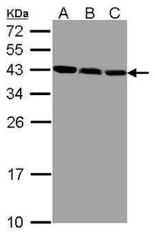ZWINT Antibody - Sample(30 ug whole cell lysate). A:293T. B: MOLT4. C: Raji. 12% SDS PAGE. ZWINT antibody diluted at 1:1000.