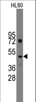 IHH Antibody - Western blot of anti-Ihh antibody (RB10378) in HL60 cell line lysates (35 ug/lane). Ihh (arrow) was detected using the purified antibody.