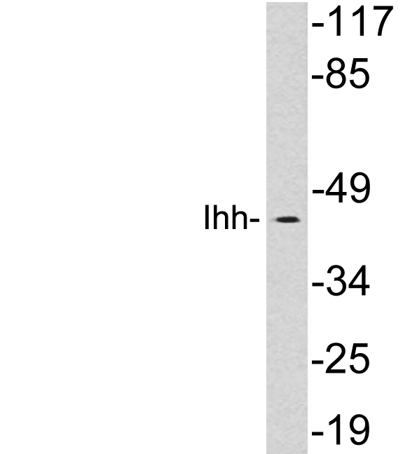 IHH Antibody - Western blot analysis of lysates from HepG2 cells, using Ihh antibody.