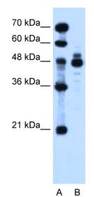 IHH Antibody - Western analysis of IHH in HepG2 cell lysate.  This image was taken for the unconjugated form of this product. Other forms have not been tested.